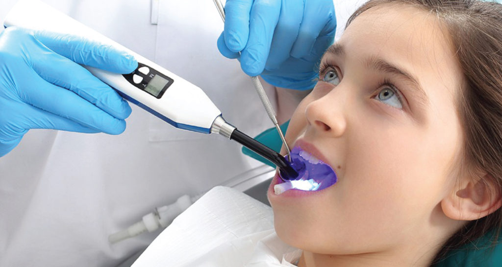 Dental Sealants In Abu Dhabi Emirates Royal Center
